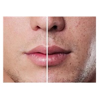 KiCA PureClear čisticí kartáček na obličej, IPX6, hloubkové čištění pórů, růžový