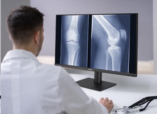 Obr. Proti oslnění, nízká odrazivost – chraňte své oči 1771422e