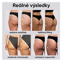 JOVS EMS-tonizující šortky (F)