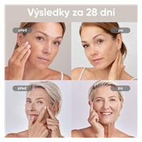 JOVS 4D v2 laserová světelná terapeutická maska